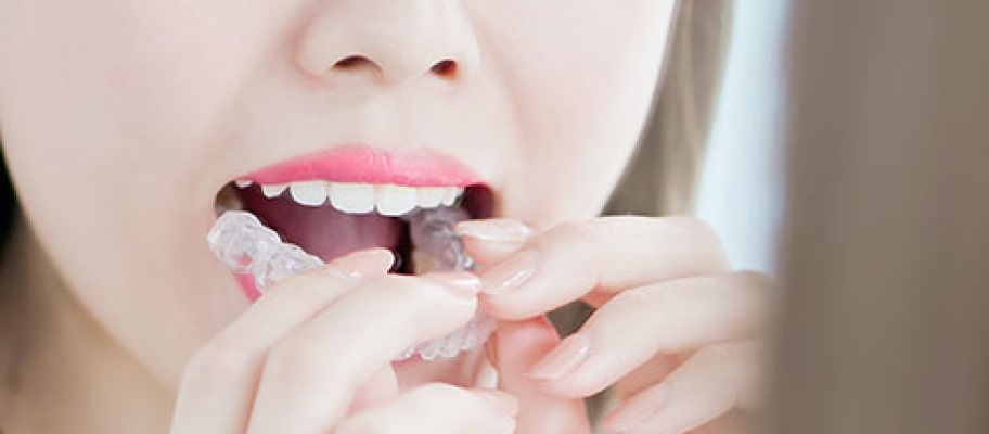 札幌インビザライン